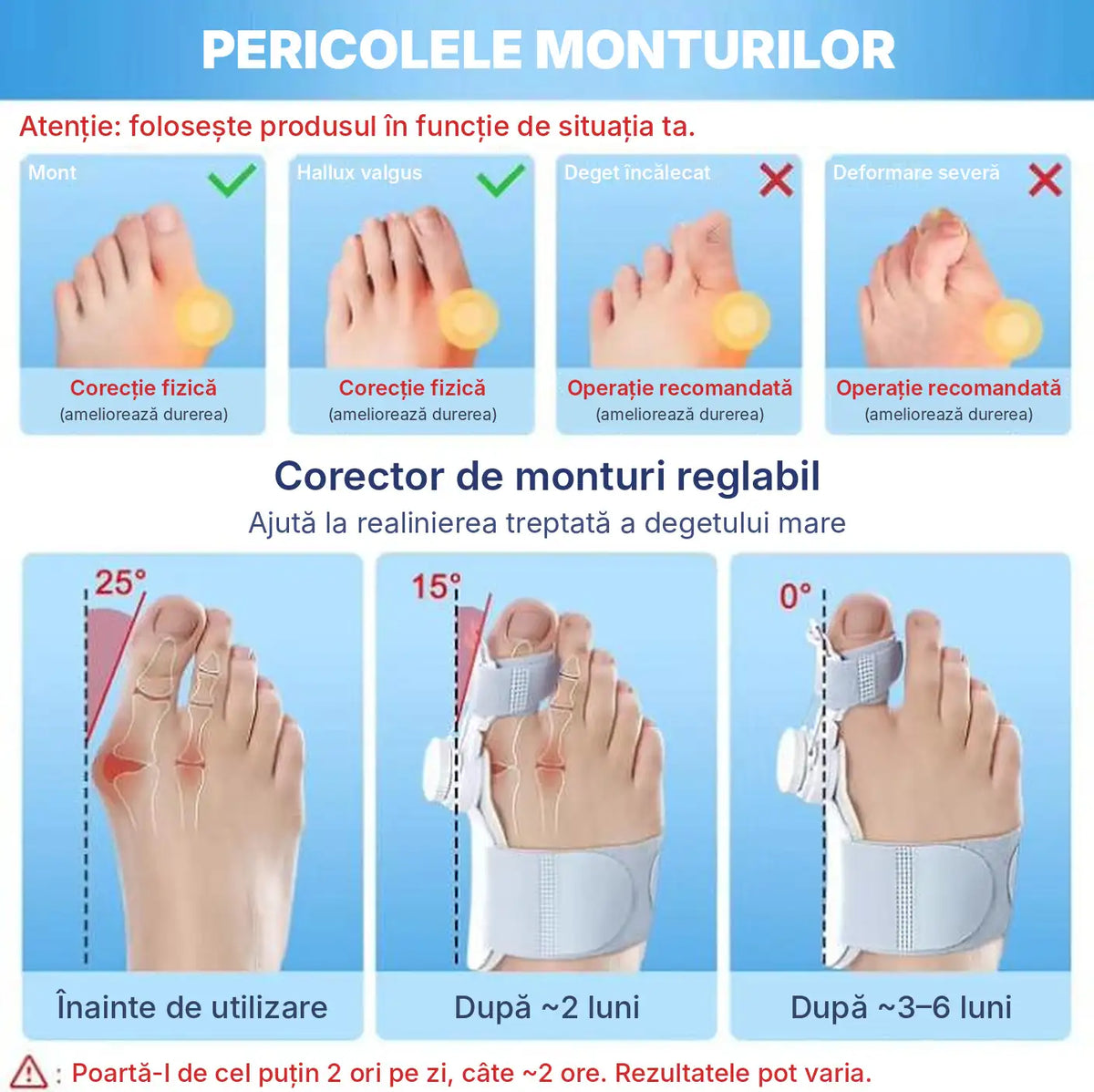 Corector reglabil pentru monturi- Hallux Valgus